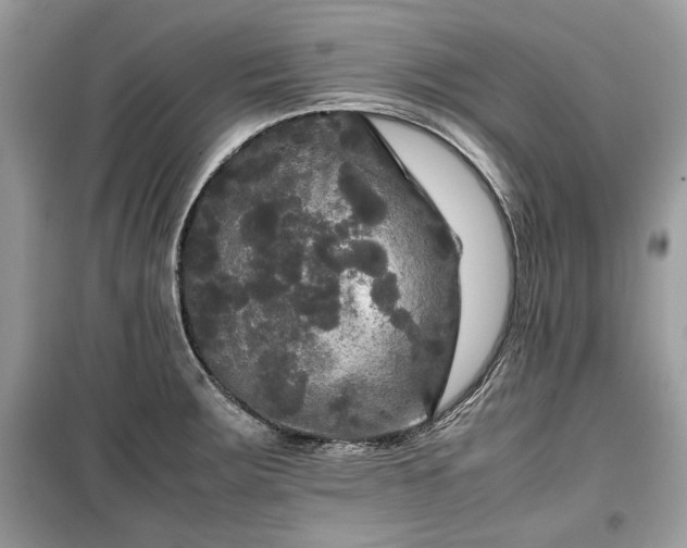 X0000099411283200805161012