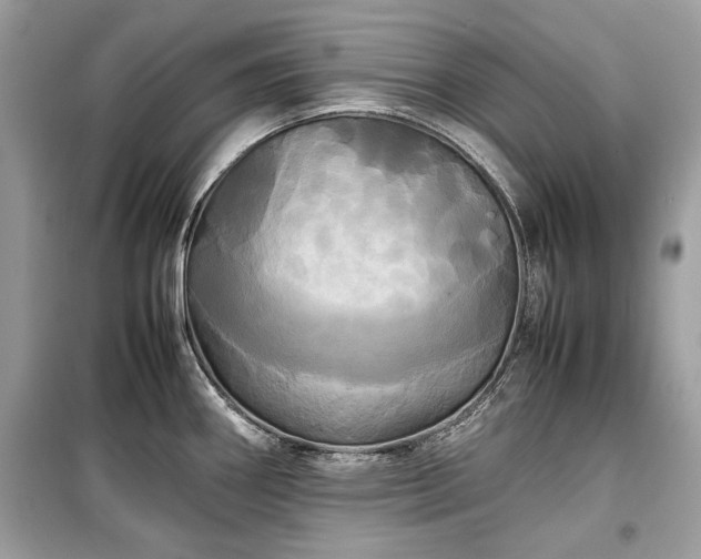 X0000099411290200805161011