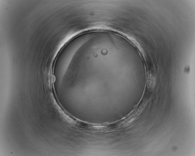 X0000099411295200805161011