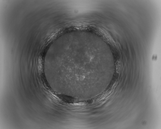 X0000099411298200805161011