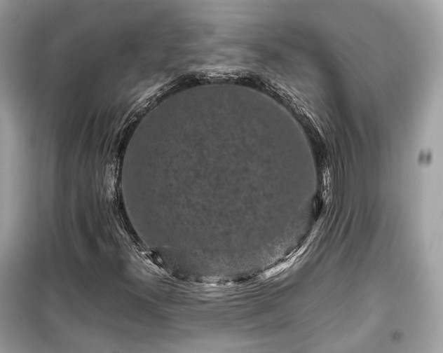 X0000099411300200805161011