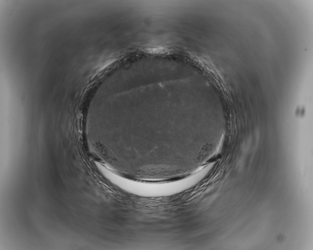 X0000099411301200805161011