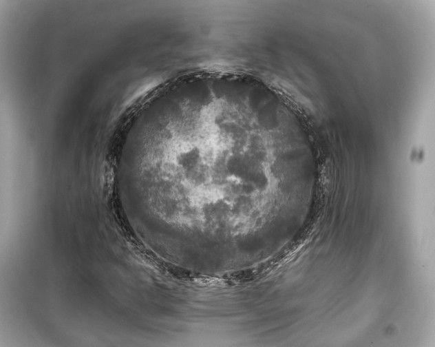 X0000099411302200805161011