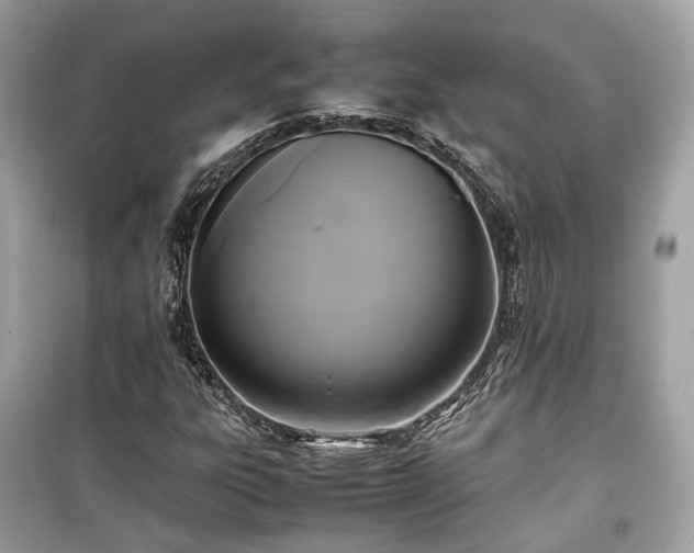 X0000099411303200805161011