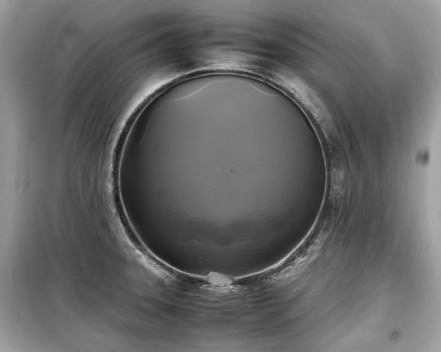X0000099411331200805161011