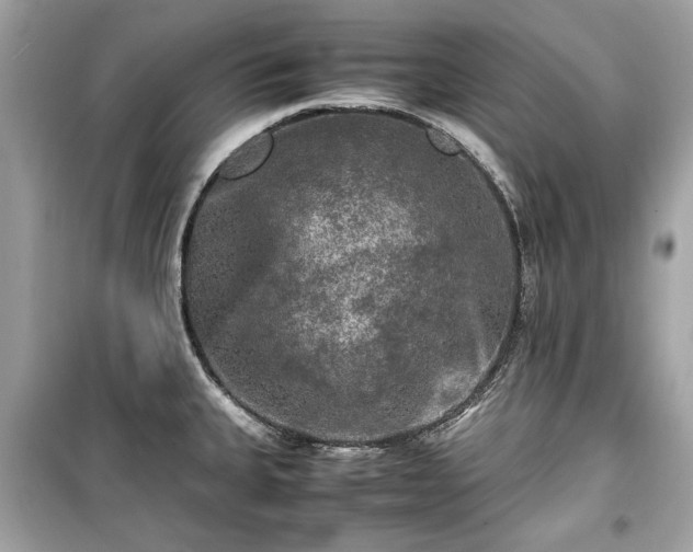 X0000099411335200805161011