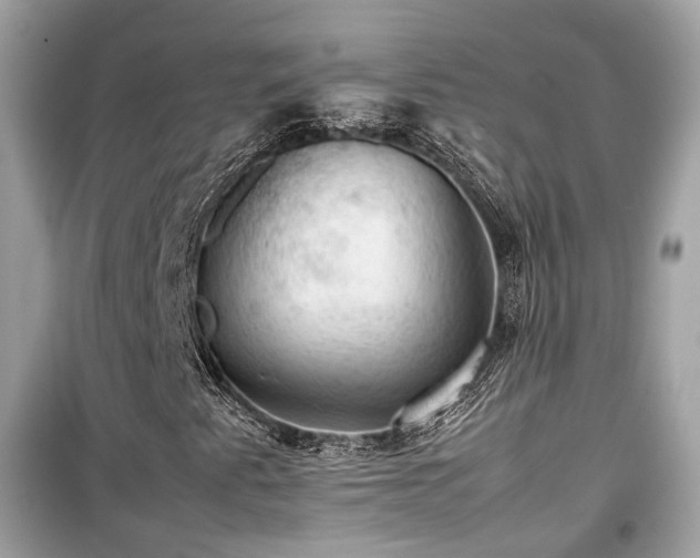 X0000099411345200805161011