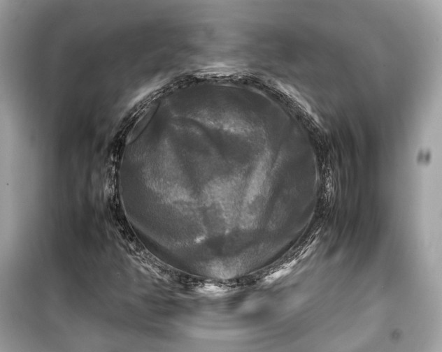 X0000099411350200805161010