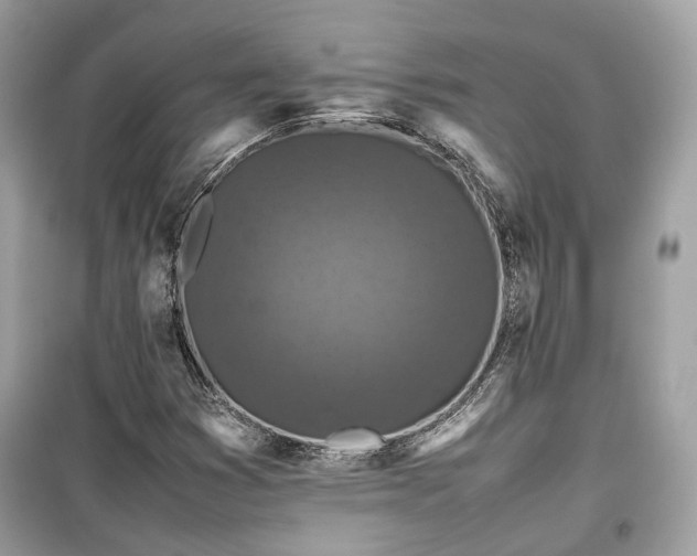 X0000099411353200805161010