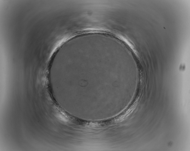 X0000099411357200805161010