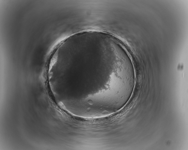 X0000099411359200805161010
