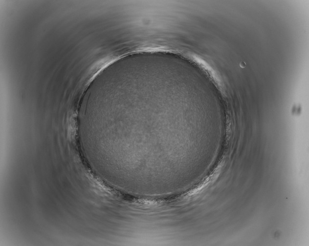 X0000099411361200805161010