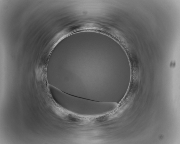 X0000099411369200805161010