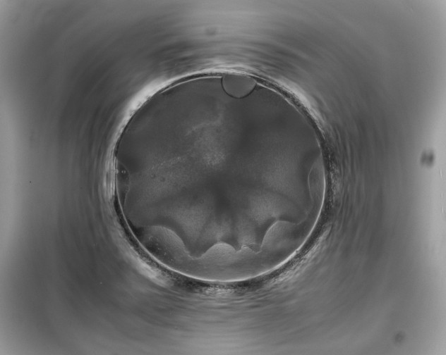 X0000099411371200805161010