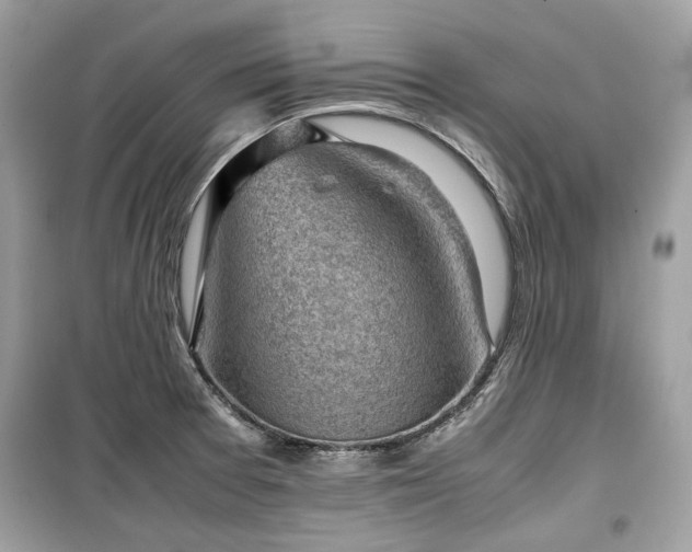 X0000099411377200805161010
