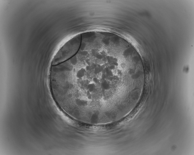 X0000099411379200805161010