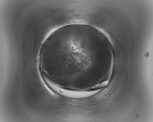 X0000099411383200805161010