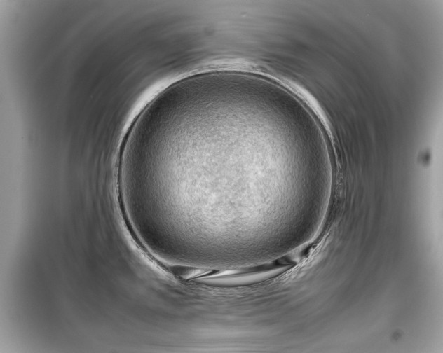 X0000099411389200805161010