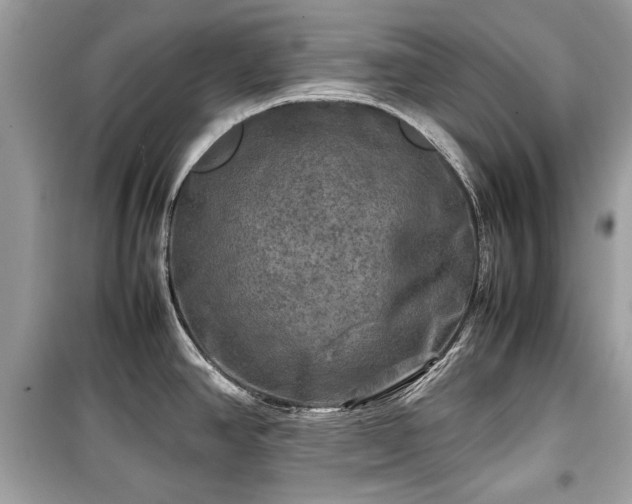 X0000099411390200805161010