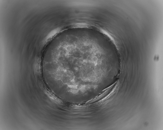 X0000099411403200805161009