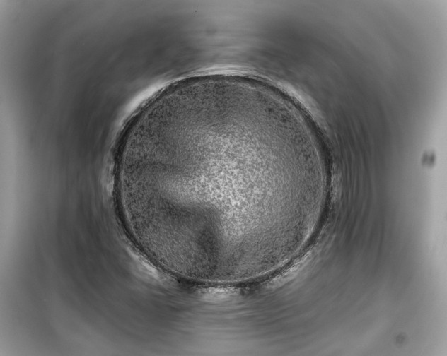 X0000099411406200805161009