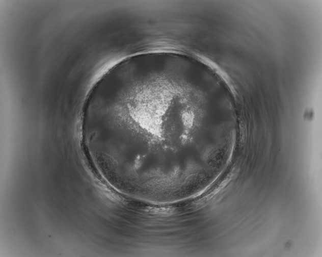X0000099411415200805161009
