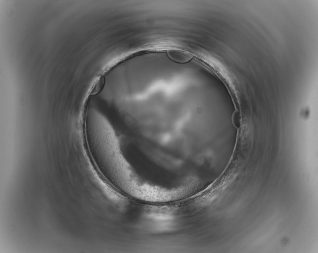 X0000099411429200805161010