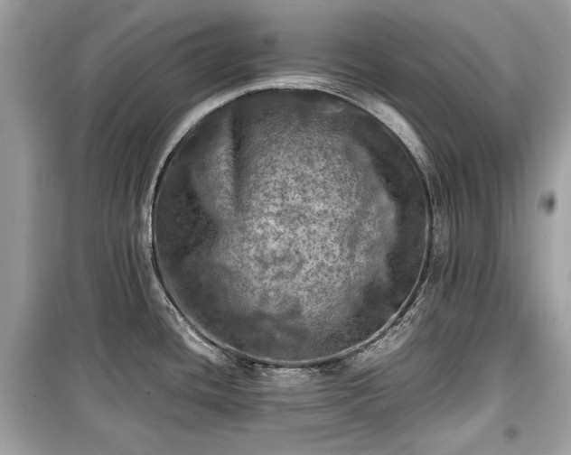 X0000099411436200805161010