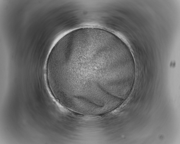 X0000099411440200805161010