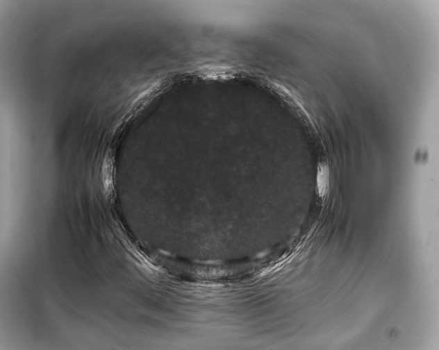 X0000099411444200805161009