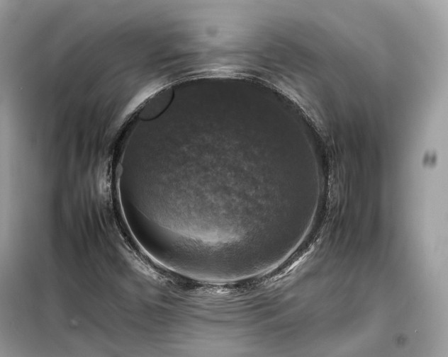 X0000099411450200805161009