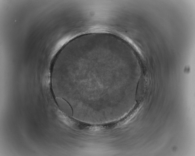 X0000099411461200805161009
