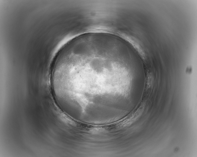 X0000099411462200805161009