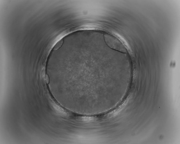 X0000099411465200805161009