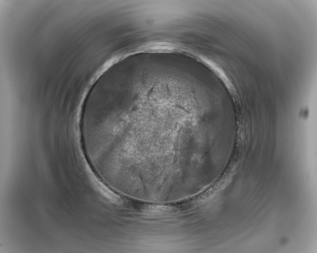 X0000099411475200805161009