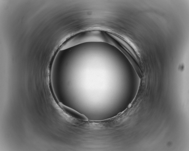 X0000099411476200805161009
