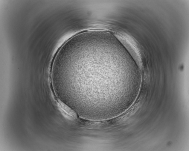 X0000099411485200805161008
