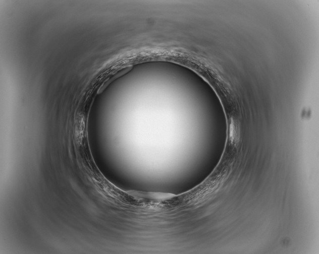 X0000099411492200805161008