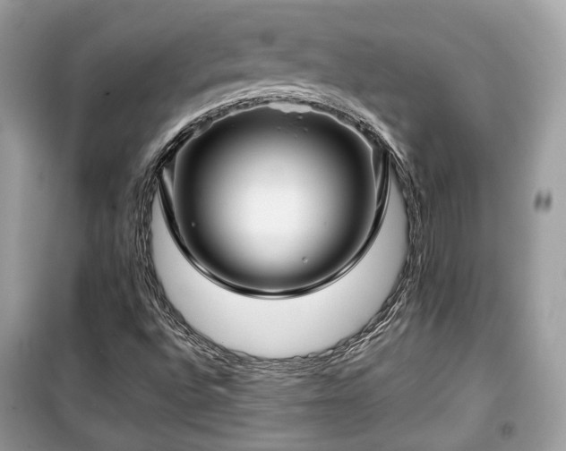 X0000099411496200805161008