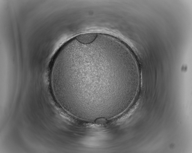 X0000099411501200805161008