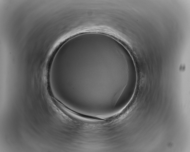 X0000099411506200805161008