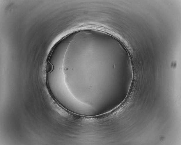 X0000099411522200805161008