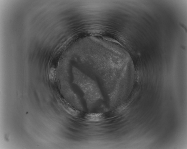 X0000099410093200805231615