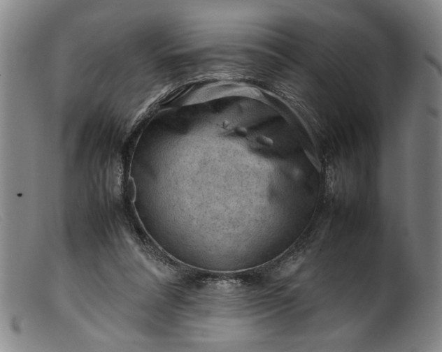 X0000099410304200805231611