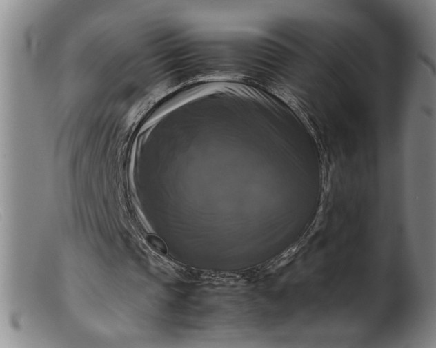 X0000099410337200805231610