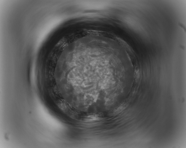 X0000099410381200805231610