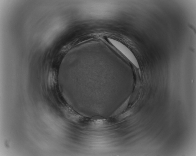 X0000099410382200805231610