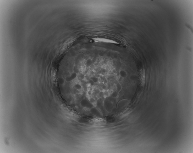 X0000099410619200805231606