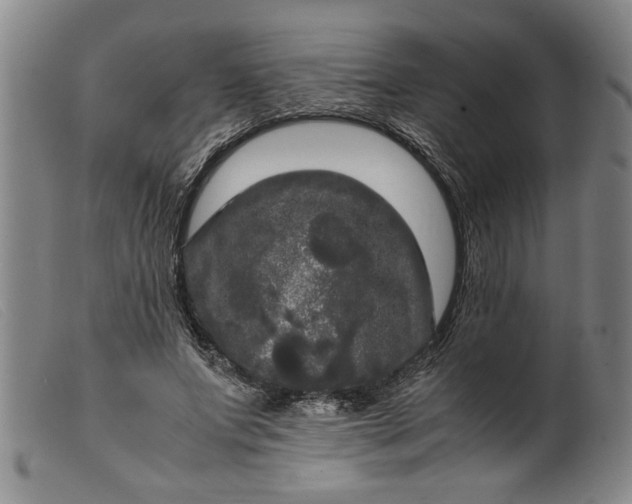 X0000099410687200805231605