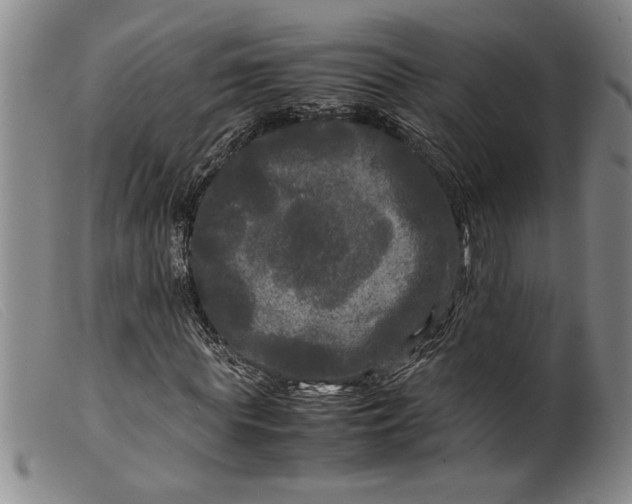 X0000099410819200805231602